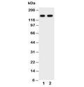 Western blot testing of anti-CD45 antibody and Lane 1: Jurkat; 2: CEM; Expected molecular weight: ~147/180-220 kDa (unmodified/glycosylated).