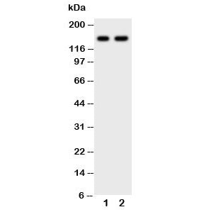 Western blot testing of anti-CD45 antibody and Lane 1: Jurkat; 2: CEM; Expected molecular weight: ~147/180-220 kDa (unmodified/glycosylated).