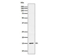Western blot testing of lysate from HeLa cells treated with Calyculin A.