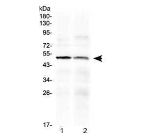 Western blot testing of human 1) PANC1 and 2) HepG2 cell lysate with HtrA3 antibody at 0.5ug/ml. Predicted molecular weight ~49 kDa.