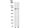 Western blot testing of human A431 [A] and mouse NIH3T3 [B] cell lysates with Gamma Catenin antibody at 0.3ug/ml. Predicted molecular weight ~82 kDa.