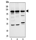 Western blot testing of human 1) A375, 2) K562 and 3) MCF7 cell lysate with EIF3B antibody. Expected molecular weight ~116 kDa.