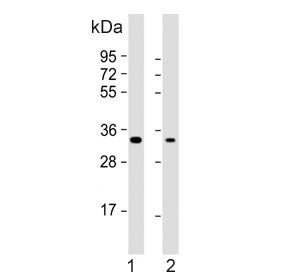 Western blot testing of human 1) HeLa and 2) PC-3 cell lysate with PI15 antibody. Predicted molecular weight ~29 kDa.