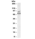 Western blot testing of human prostate lysate with MARK4 antibody at 0.5ug/ml. Predicted molecular weight: ~75kDa.