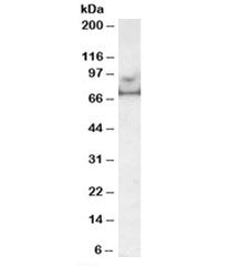 Western blot testing of human prostate lysate with MARK4 antibody at 0.5ug/ml. Predicted molecular weight: ~75kDa.