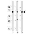 Western blot testing of CHRNE antibody at 1:2000: Lane 1) human skeletal muslce, 2) mouse skeletal muscle and 3) rat skeletal muscle lysate. Predicted molecular weight ~55 kDa.