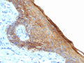 IHC staining of FFPE human skin with recombinant Basic Cytokeratin antibody (clone rKRTH/6617). HIER: boil tissue sections in pH 9 10mM Tris with 1mM EDTA for 20 min and allow to cool before testing.