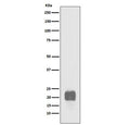 Western blot testing of human NCCIT cell lysate with recombinant CRIPTO antibody. Predicted molecular weight ~21 kDa.