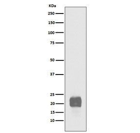 Western blot testing of human NCCIT cell lysate with recombinant CRIPTO antibody. Predicted molecular weight ~21 kDa.