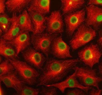 Immunofluorescent staining of TSR1 using anti-TSR1 antibody (green) and anti-Alpha Tubulin antibody (red). TSR1 was detected in an immunocytochemical section of cells. Enzyme antigen retrieval was performed using IHC enzyme antigen retrieval reagent for 15 mins. The cells were blocked with 10% goat serum. And then incubated with 5 ug/ml rabbit anti-TSR1 antibody and mouse anti-Beta Tubulin antibody overnight at 4oC.