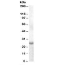 Western blot testing of human muscle lysate with APOBEC2 antibody at 1ug/ml. Predicted molecular weight: ~26kDa.