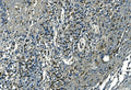 IHC staining of FFPE human appendicitis tissue with Azurocidin antibody. HIER: boil tissue sections in pH8 EDTA for 20 min and allow to cool before testing.