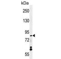 Western blot testing of human MCF7 cell lysate with WDR27 antibody. Predicted molecular weight ~90 kDa.
