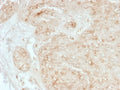 IHC staining of FFPE human adrenal gland tissue with StAR antibody (clone STAR/3976). HIER: boil tissue sections in pH 9 10mM Tris with 1mM EDTA for 20 min and allow to cool before testing.