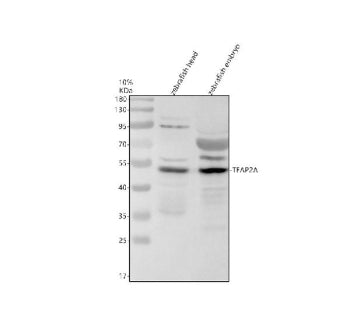 Western blot analysis of Tfap2a protein using Zebrafish Tfap2a antibody and 1) zebrafish head tissue lysates and 2) zebrafish embryo tissue lysates. Predicted molecular weight ~50 kDa.