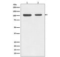 Western blot testing of human 1) Jurkat and 2) MCF7 cell lysate with Rb1 antibody. Predicted molecular weight ~110 kDa.