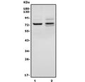 Western blot testing of human 1) HL60 and 2) A549 cell lysate with IL-18R Beta antibody. Predicted molecular weight ~72 kDa.