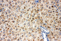 IHC staining of FFPE rat liver tissue with Lipoamide Dehydrogenase antibody. HIER: boil tissue sections in pH6 citrate buffer for 20 min and allow to cool before testing.