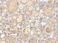 IHC: Formalin-fixed, paraffin-embedded human thyroid gland stained with recombinant TG antibody (clone r6E1). Required HIER: boil tissue sections in pH 9 10mM Tris with 1mM EDTA for 10-20 min followed by cooling at RT for 20 min.