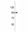 Nephrin antibody western blot analysis in SK-BR-3 lysate. Ab used at 1:100 dilution. Predicted molecular weight ~150 kDa but often observed at a lower size.
