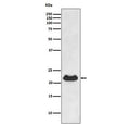 Western blot testing of human fetal heart lysate with Alpha B Crystallin antibody. Predicted molecular weight ~20 kDa.