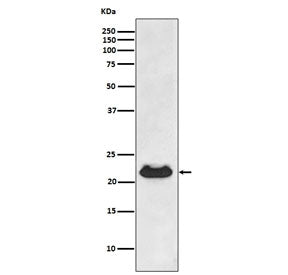 Western blot testing of human fetal heart lysate with Alpha B Crystallin antibody. Predicted molecular weight ~20 kDa.