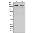 Western blot testing of human 1) HeLa and 2) Jurkat cell lysate with TOP2A antibody. Predicted molecular weight ~174 kDa.