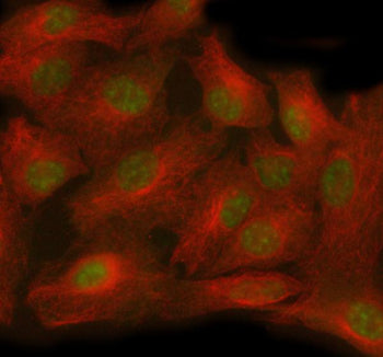 Immunofluorescent staining of TTC36 using anti-TTC36 antibody (green) and anti-Beta Tubulin antibody (red). TTC36 was detected in immunocytochemical section of cell. Enzyme antigen retrieval was performed using IHC enzyme antigen retrieval reagent for 15 mins. The cells were blocked with 10% goat serum. And then incubated with 5 ug/ml rabbit anti-TTC36 antibody and mouse anti-Beta Tubulin antibody overnight at 4oC.