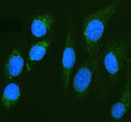 Immunofluorescent staining of CAPN6 using anti-CAPN6 antibody (green). CAPN6 was detected in an immunocytochemical section of U2OS cells. Enzyme antigen retrieval was performed using IHC enzyme antigen retrieval reagent for 15 mins. The cells were blocked with 10% goat serum. And then incubated with 5 ug/ml rabbit anti-CAPN6 antibody overnight at 4oC. DyLight 488 Conjugated Goat Anti-Rabbit IgG was used as secondary antibody at 1:500 dilution and incubated for 30 min at 37oC.
