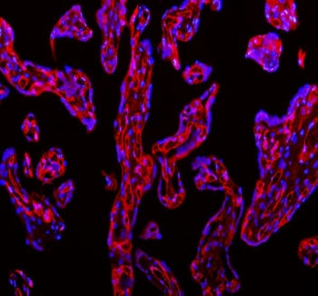Immunofluorescent staining of FFPE human placental tissue with CD31 antibody (red) and DAPI nuclear stain (blue). HIER: steam section in pH8 EDTA buffer for 20 min.