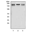 Western blot testing of 1) rat brain, 2) rat C6 and 3) mouse brain lysate with NMDAR2B antibody. Expected molecular weight ~166 kDa but may be observed at higher molecular weights due to glycosylation.