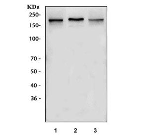 Western blot testing of 1) rat brain, 2) rat C6 and 3) mouse brain lysate with NMDAR2B antibody. Expected molecular weight ~166 kDa but may be observed at higher molecular weights due to glycosylation.