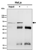 Immunoprecipitation analysis using the Hsp70 antibody at 1:50 dilution. Western blot at 1:1K dilution. The predicted molecular weight of Hsp70 is ~70 kDa and ~64 kDa (two isoforms).