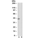 Western blot testing of HeLa nuclear [A] and cytosolic [B] lysate with TBP antibody at 0.3ug/ml. Predicted molecular weight ~38kDa.