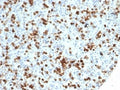 IHC staining of FFPE human spleen tissue with recombinant CD59 antibody (clone MACIF/7021R). HIER: boil tissue sections in pH 9 10mM Tris with 1mM EDTA for 20 min and allow to cool before testing.