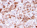 IHC testing of FFPE human pituitary tissue with Prolactin antibody (clone PRL/2644). Required HIER: boil tissue sections in pH 9 10mM Tris with 1mM EDTA for 10-20 min followed by cooling at RT for 20 min.