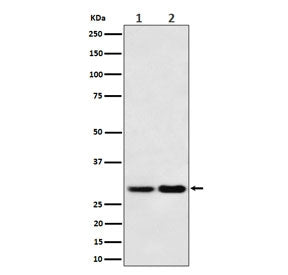 Western blot testing of 1) human 293T and 2) mouse NIH 3T3 cell lysate with MTAP antibody. Expected molecular weight: 26-38 kDa (multiple isoforms).