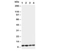 Western blot testing of Apelin antibody and Lane 1: U87; 2: MCF-7; 3: HeLa; 4: MM453 cell lysate