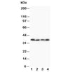 Western blot testing of Stra8 antibody and Lane 1: A231; 2: Jurkat; 3: HT1080; 4: SCG cell lysate. Predicted size: ~37KD