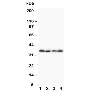 Western blot testing of Stra8 antibody and Lane 1: A231; 2: Jurkat; 3: HT1080; 4: SCG cell lysate. Predicted size: ~37KD