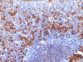 IHC: Formalin-fixed, paraffin-embedded human tonsil stained with biotinylated Lambda Light Chain Ab probe followed by anti-Biotin antibody (SPM375).
