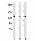 Western blot analysis of lysate from 293, HUVEC, T47D cell line (left to right) using GAB1 antibody diluted at 1:1000 for each lane. Predicted molecular weight ~76 kDa, also observed at 100-110 kDa.