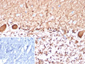 IHC staining of FFPE human brain tissue with S100B antibody (clone S100B/4148). Inset: PBS used in place of primary Ab (secondary Ab negative control). HIER: boil tissue sections in pH 9 10mM Tris with 1mM EDTA for 20 min and allow to cool before testing.