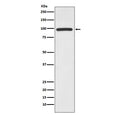 Western blot testing of human Jurkat cell lysate with HMGCR antibody. Predicted molecular weight ~97 kDa.