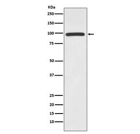 Western blot testing of human Jurkat cell lysate with HMGCR antibody. Predicted molecular weight ~97 kDa.