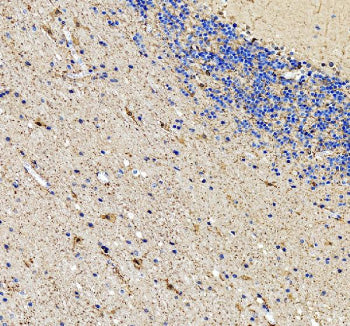 Immunohistochemical staining of ENO1 using anti-ENO1 antibody. ENO1 was detected in a paraffin-embedded section of human cerebellum tissue. Heat mediated antigen retrieval was performed in EDTA buffer (pH 8.0, epitope retrieval solution). The tissue section was blocked with 10% goat serum. The tissue section was then incubated with 2 ug/ml rabbit anti-ENO1 antibody overnight at 4oC. Peroxidase Conjugated Goat Anti-rabbit IgG was used as secondary antibody and incubated for 30 min at 37oC.