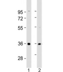 Western blot testing of human 1) liver and 2) SK-BR-3 cell lysate with AKR7A3 antibody at 1:2000. Predicted molecular weight: 37 kDa.