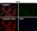 Immunofluorescent analysis using the GNAQ antibody (green) at 1:50 dilution.