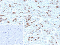 IHC staining of FFPE human heart tissue with CDH2 antibody (clone CDH2/9492). Inset: PBS used in place of primary Ab (secondary Ab negative control). HIER: boil tissue sections in pH 9 10mM Tris with 1mM EDTA for 20 min and allow to cool before testing.