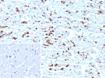 IHC staining of FFPE human heart tissue with CDH2 antibody (clone CDH2/9492). Inset: PBS used in place of primary Ab (secondary Ab negative control). HIER: boil tissue sections in pH 9 10mM Tris with 1mM EDTA for 20 min and allow to cool before testing.